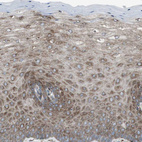 Immunohistochemical staining of human cervix shows moderate granular cytoplasmic positivity in squamous epithelial cells.
