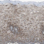 Immunohistochemical staining of human cervix shows moderate granular cytoplasmic positivity in squamous epithelial cells.
