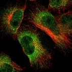 Immunofluorescent staining of human cell line U-251 MG shows localization to nucleoplasm & endoplasmic reticulum.