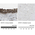 Anti-MYOF Antibody