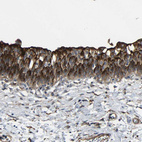Immunohistochemical staining of human urinary bladder shows strong membranous positivity in urothelial cells.