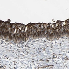Immunohistochemical staining of human urinary bladder shows strong membranous positivity in urothelial cells.