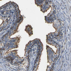 Anti-MYOF Antibody