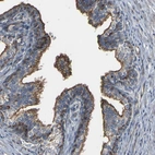 Immunohistochemical staining of human prostate shows moderate to strong membranous positivity in glandular cells.