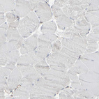 Immunohistochemical staining of human skeletal muscle shows no positivity in myocytes as expected.