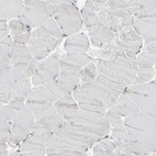 Immunohistochemical staining of human skeletal muscle shows no positivity in myocytes as expected.