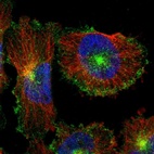 Immunofluorescent staining of human cell line U-251 MG shows localization to plasma membrane & vesicles.