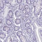 Immunohistochemical staining of human duodenum shows weak cytoplasmic positivity in glandular cells.