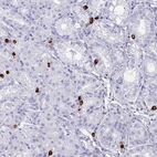 Immunohistochemical staining of human stomach shows strong cytoplasmic positivity in glandular cells.
