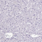 Immunohistochemical staining of human liver shows no positivity in hepatocytes as expected.