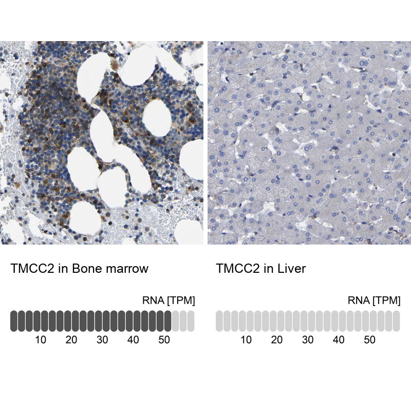 Anti-TMCC2 Antibody