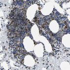 Immunohistochemical staining of human bone marrow shows strong cytoplasmic positivity in hematopoietic cells.
