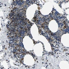 Immunohistochemical staining of human bone marrow shows strong cytoplasmic positivity in hematopoietic cells.