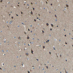 Immunohistochemical staining of human cerebral cortex shows strong cytoplasmic positivity in neuronal cells.