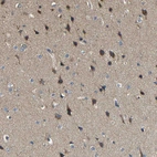 Immunohistochemical staining of human cerebral cortex shows strong cytoplasmic positivity in neuronal cells.