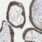 Immunohistochemical staining of human placenta shows strong cytoplasmic positivity in trophoblastic cells.