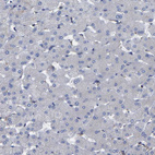 Immunohistochemical staining of human liver shows no positivity in hepatocytes as expected.