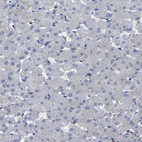 Immunohistochemical staining of human liver shows no positivity in hepatocytes as expected.