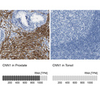 Anti-CNN1 Antibody