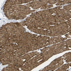 Immunohistochemical staining of human smooth muscle shows strong cytoplasmic positivity in smooth muscle cells.