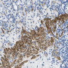 Immunohistochemical staining of human rectum shows strong cytoplasmic positivity in smooth muscle cells.