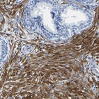 Immunohistochemical staining of human prostate shows strong cytoplasmic positivity in smooth muscle cells.