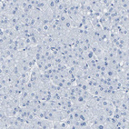 Anti-CNN1 Antibody