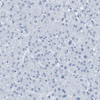 Immunohistochemical staining of human liver shows no positivity in hepatocytes as expected.