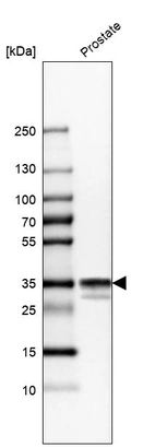 Western blot analysis in human prostate tissue.