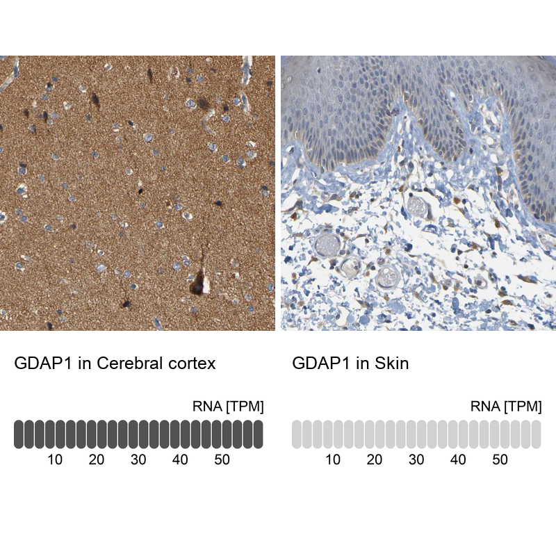 Anti-GDAP1 Antibody