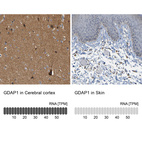 Anti-GDAP1 Antibody