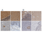 Immunohistochemical staining of human cerebellum, cerebral cortex, pancreas and skin using Anti-GDAP1 antibody HPA014266 (A) shows similar protein distribution across tissues to independent antibody HPA024334 (B).