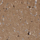 Immunohistochemical staining of human cerebral cortex shows strong cytoplasmic positivity in neurons.