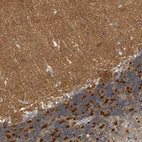 Immunohistochemical staining of human cerebellum shows strong cytoplasmic positivity in Purkinje cells.