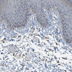 Immunohistochemical staining of human skin shows negative cytoplasmic positivity in squamous epithelial cells as expected.