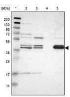 Lane 1: Marker [kDa] 230, 130, 95, 72, 56, 36, 28, 17, 11_br/_Lane 2: Human cell line RT-4_br/_Lane 3: Human cell line U-251MG sp_br/_Lane 4: Human plasma (IgG/HSA depleted)_br/_Lane 5: Human liver tissue