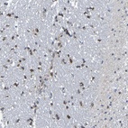 Anti-TMCC3 Antibody