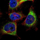 Immunofluorescent staining of human cell line U-251 MG shows localization to endoplasmic reticulum.