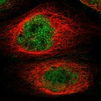 Immunofluorescent staining of human cell line A-431 shows localization to nucleoplasm.