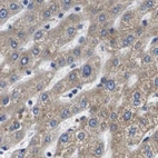 Immunohistochemical staining of human liver using Anti-MARCH7 antibody HPA014275.
