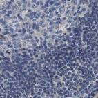 Immunohistochemical staining of human lymph node using Anti-MARCH7 antibody HPA014275.