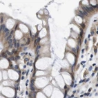 Immunohistochemical staining of human colon using Anti-MARCH7 antibody HPA014275.