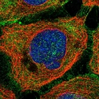 Immunofluorescent staining of human cell line A-431 shows localization to plasma membrane & cytosol.