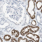 Anti-LRRK2 Antibody