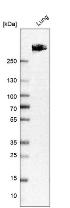Western blot analysis in human lung tissue.