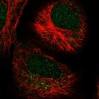 Immunofluorescent staining of human cell line A549 shows localization to nucleus & vesicles.