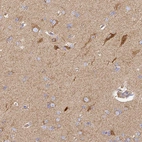 Immunohistochemical staining of human cerebral cortex shows moderate granular cytoplasmic positivity.