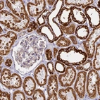 Immunohistochemical staining of human kidney shows strong granular cytoplasmic positivity in cells in tubules.