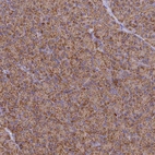 Immunohistochemical staining of human pancreas shows moderate granular cytoplasmic positivity in exocrine glandular cells.