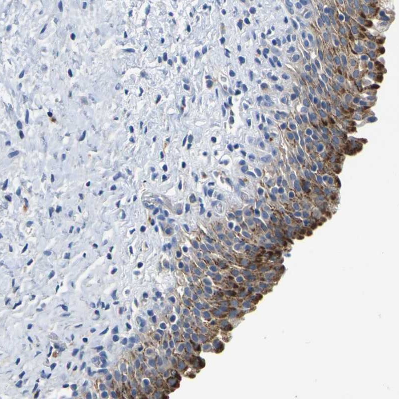 Anti-QRFPR Antibody